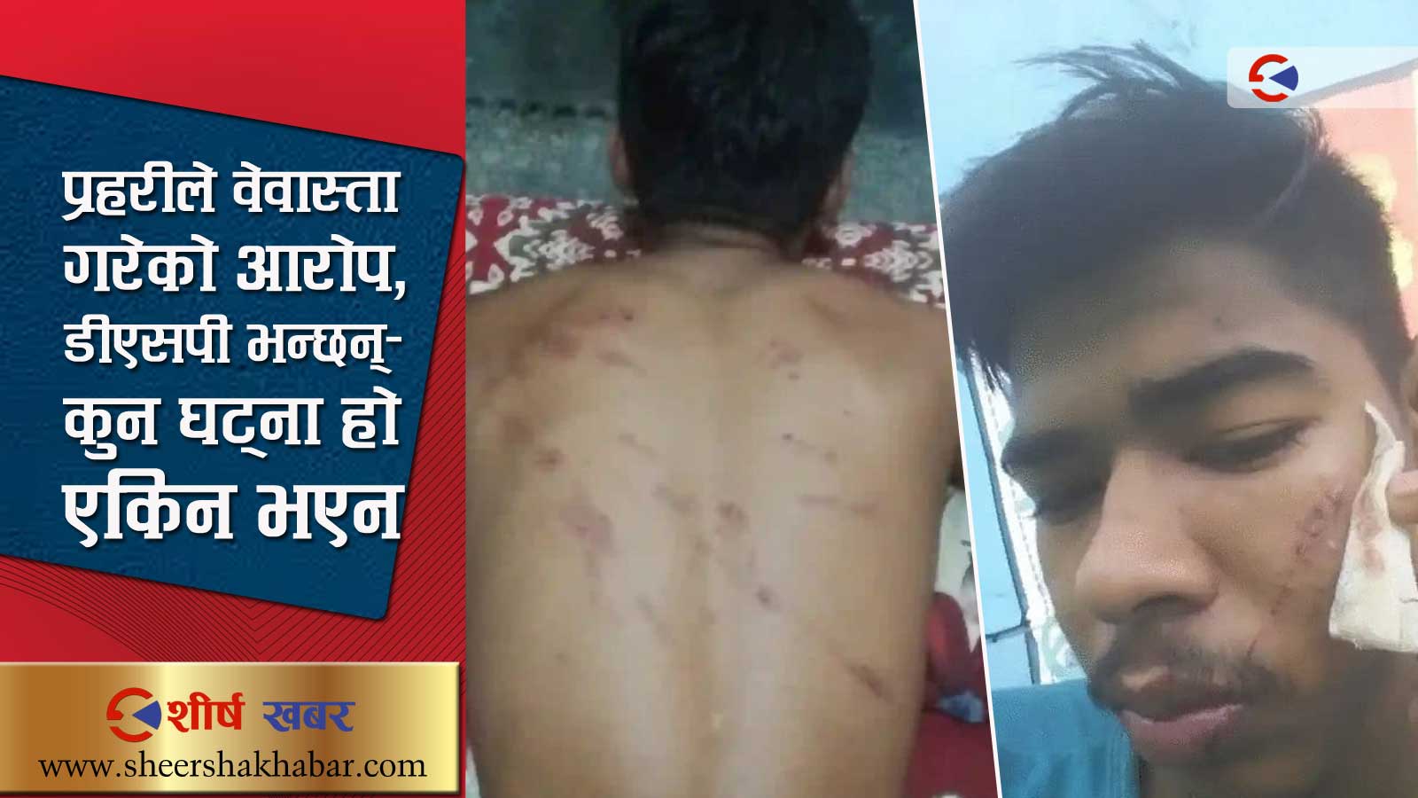 सप्तरीमा पटका पड्काएको विषयमा १३ वर्षिय बालकमाथि छिमेकीद्वारा निर्घात कुटपिट