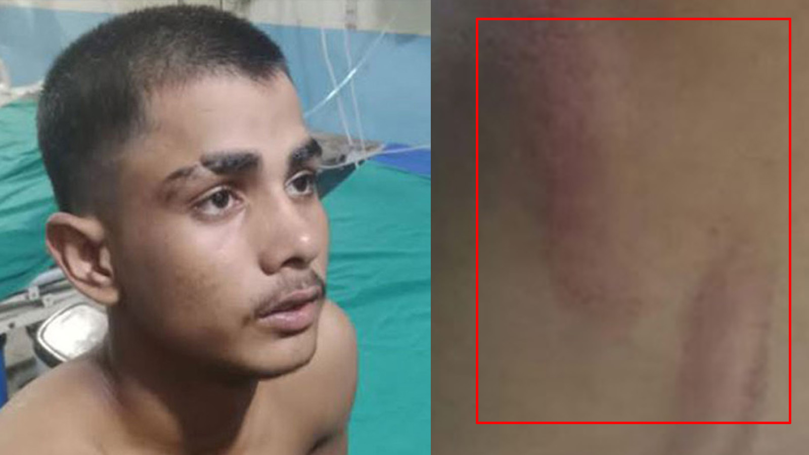 कक्षा ९ मा अध्ययनरत बालकलाई प्रअसहित तीन जनाले ढोका थुनेर निर्धाट कुटे