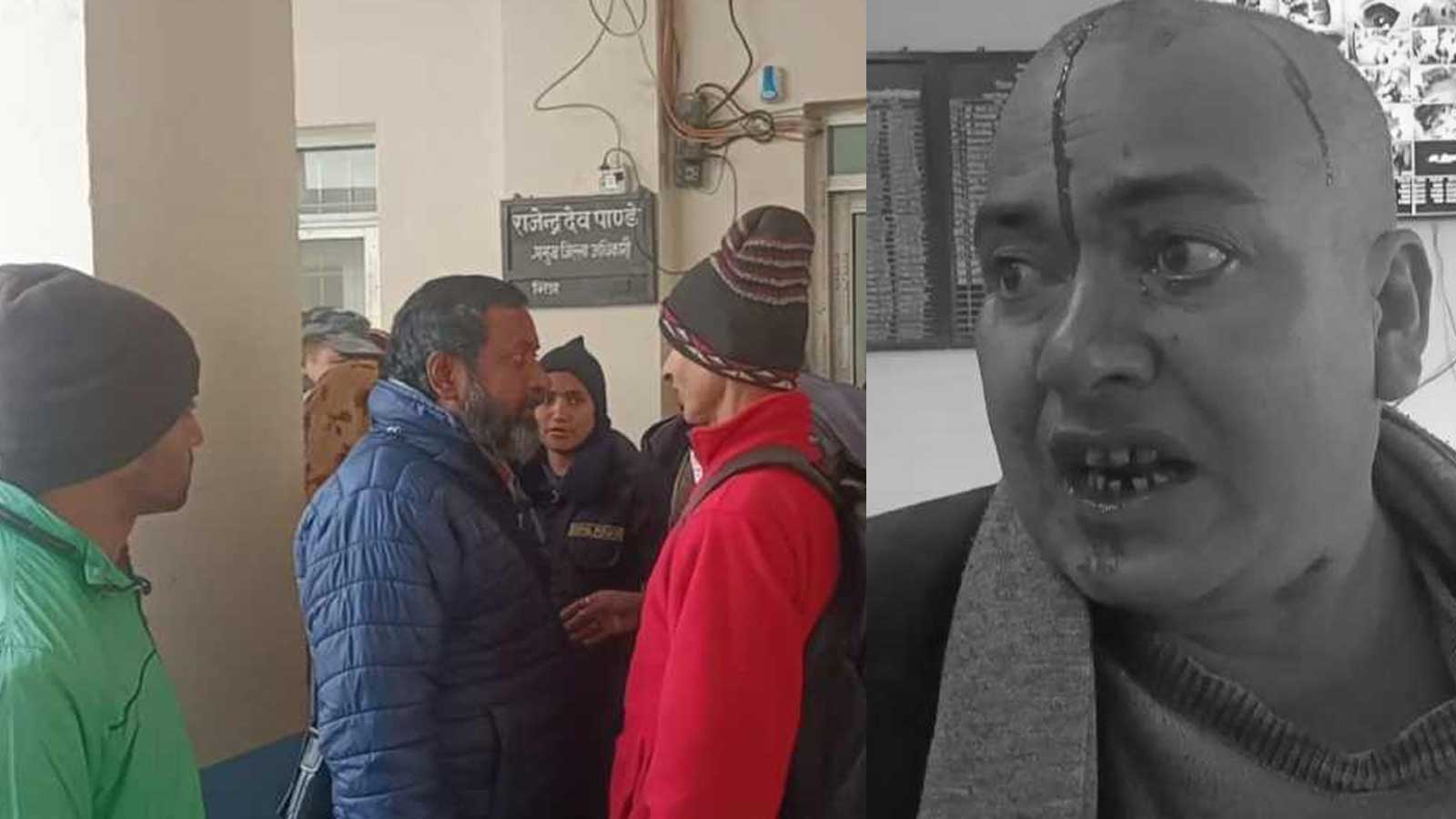 सीडीओ कार्यालयमै मिटरब्याज पीडित र साहुबीच कुटाकुट, साहुको टाउको फुट्यो