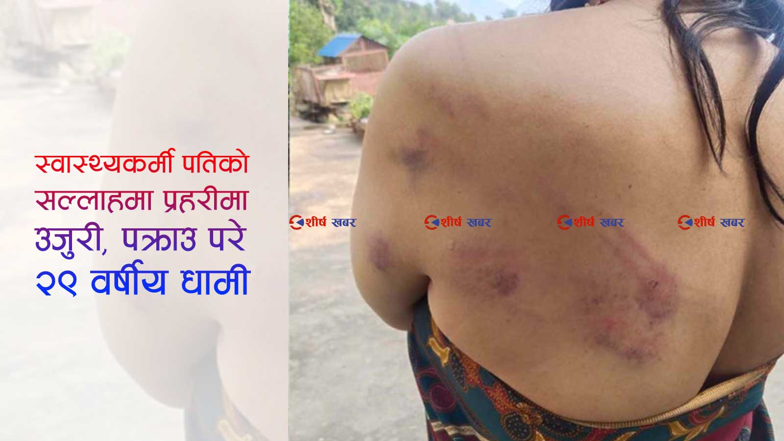 बोक्सीको आरोपमा कार्यपालिकाको मेलमिलाप सदस्य नै निर्घात कुटिएईन