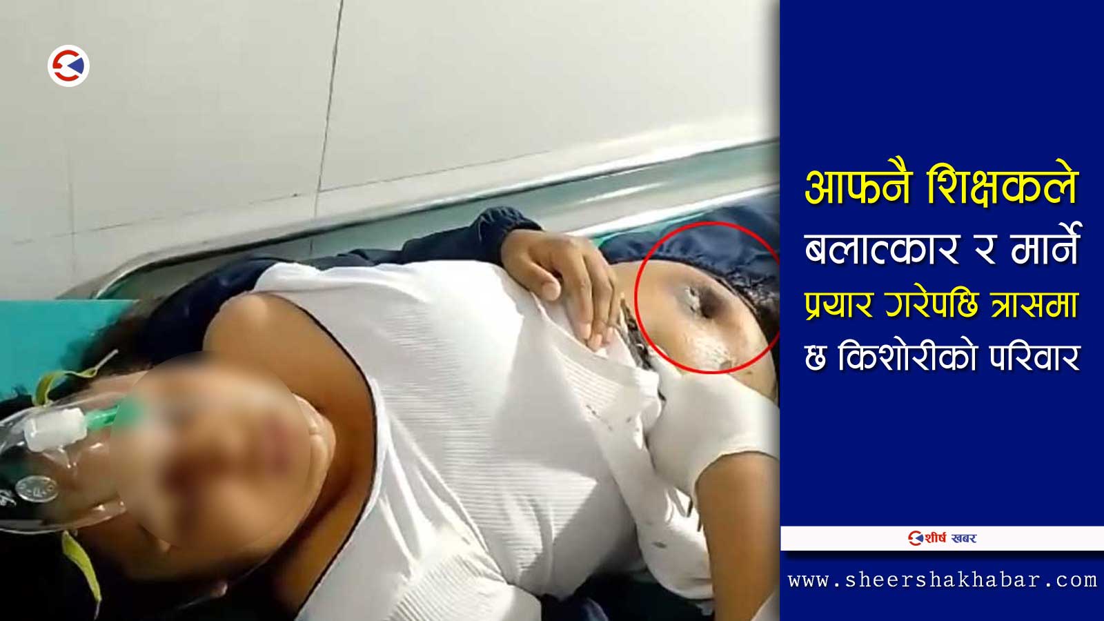 उदयपुरकी किशोरीलाई बलात्कार गरी गोली हानेर हत्या गर्न खोज्ने अभियुक्तलाई पक्राउ गर्न एक हप्ते अल्टिमेटम