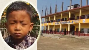 शिक्षिकाले हानेको लठ्ठीले लागेर युकेजीमा पढ्ने ६ वर्षीय बालकको आँखा फुट्यो, शिक्षिका फरार