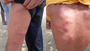 सिराहमा बोर्डिङ स्कुलका शिक्षकले कुटेर ८ कक्षामा पढ्ने १३ वर्षीय बालक घाईते, अस्पताल भर्ना गरियो