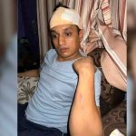 रास्वपाका नेतामाथि अज्ञात समूहको आक्रमण, रड प्रहारको चोटले टाउकोमा १० टाँका