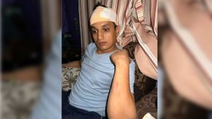 रास्वपाका नेतामाथि अज्ञात समूहको आक्रमण, रड प्रहारको चोटले टाउकोमा १० टाँका