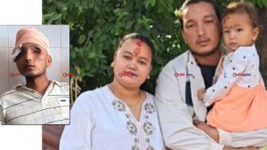 क्रोएसिया उड्नै लागेका सन्तोष बोहराको जेनजी आन्दोलनमा दुवै आँखा गुमेः उज्यालोसँगै जीवनका सबै सपना अन्धकारमा