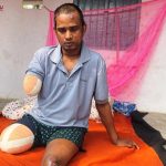 साउदीबाट फर्किएका सप्तरीका देवचन्द्रमाथि बर्बर हमलाः टेम्पो दुर्घटनामा पारेर लुटपाट, हात–खुट्टै काटियो