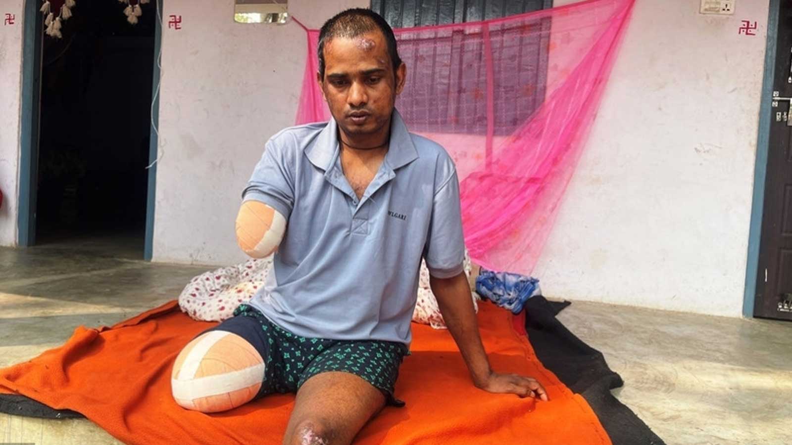 साउदीबाट फर्किएका सप्तरीका देवचन्द्रमाथि बर्बर हमलाः टेम्पो दुर्घटनामा पारेर लुटपाट, हात–खुट्टै काटियो