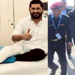 दाहिनेमा प्लास्टर, देब्रेमा ब्याण्डेजः रविको खुट्टामा चोट कि राजनीतिक नाटक?