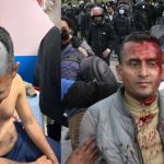 ओली पक्राउविरुद्ध देशभर उग्र प्रदर्शन, काठमाडौँमा प्रहरी–एमाले कार्यकर्ता झडप