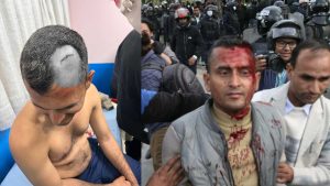 ओली पक्राउविरुद्ध देशभर उग्र प्रदर्शन, काठमाडौँमा प्रहरी–एमाले कार्यकर्ता झडप