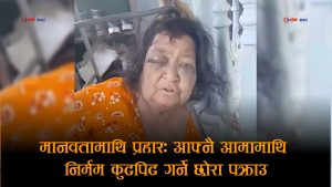 निर्दयी छोराको क्रूरताः ७९ वर्षीया आमामाथि निर्घात कुटपिट, भीडीओ भाइरल भएपछि पक्राउ