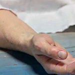 जापानिज इन्सेफ्लाइटिसका कारण सप्तरीसहित तीन जिल्लामा १० जनाको मृत्यु