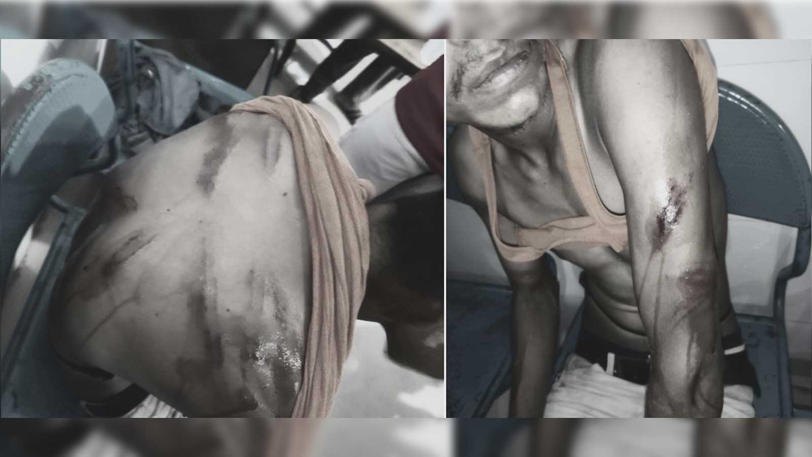 रौतहटमा जिप चालकलाई अपहरण शैलीमा घर पुर्‍याएर कुटपिट, बाबु पक्राउ–छोरा फरार